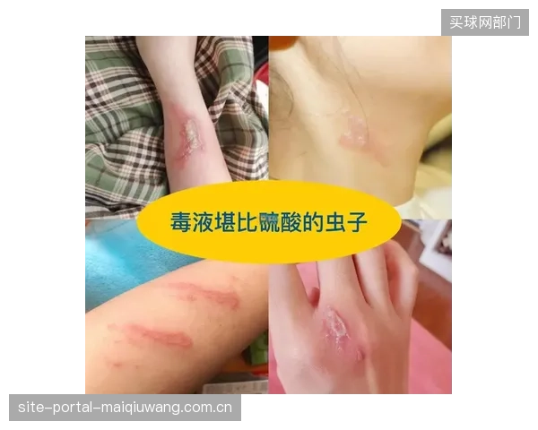 当皮肤过敏已成为影响运动员状态的隐形杀手时，为何俱乐部在防护用品采购上仍困于成本思维？